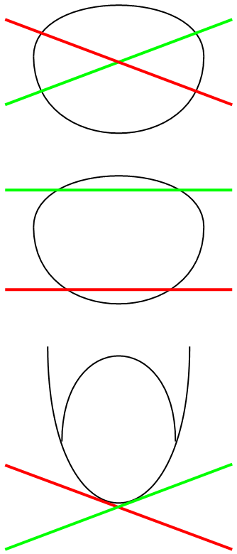 Saitenkontakt links